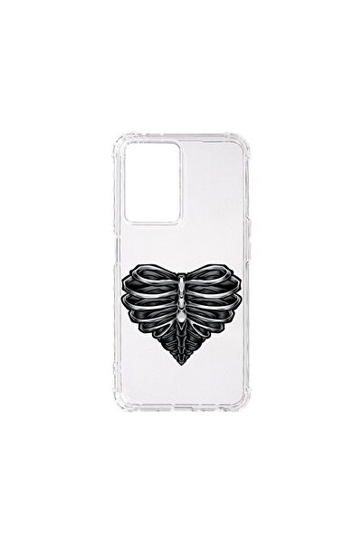 bestcase Husa BestCase¬Æ Anti Shock 1.5MM, Compatibila Cu OPPO A77s, Skeleton...