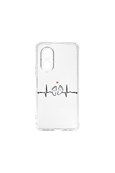 bestcase Αντικραδασμική Θήκη 1.5mm, Συμβατή με Huawei Nova 9 SE, My Little Lo...