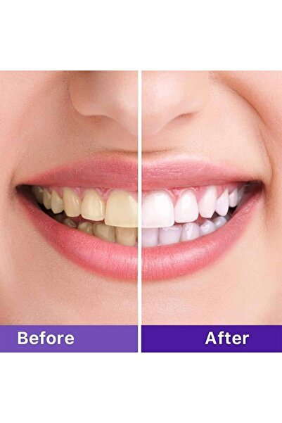 Other High Smiles V34 Teeth Whitening Color Corrector Serum 30ml