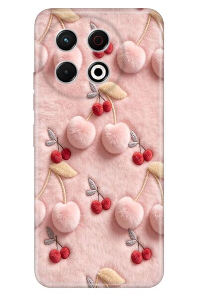 TECNO Spark 30 Pro Kılıf Kiraz-79990 Temalı Desenli Darbe Emici Silikon