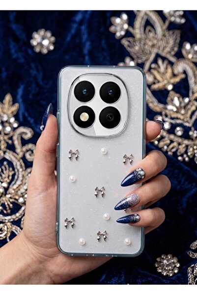 AKSEFİZZ Redmi Note 15 Pro Plus 5G - Poco M8 Pro Kılıf Zarif Mini Figür Desen...