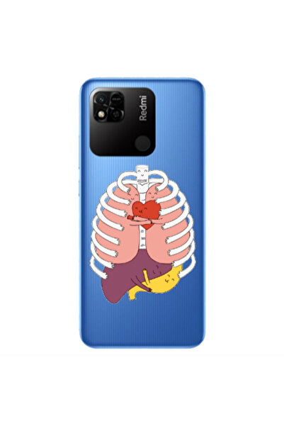 Other Xiaomi Redmi 10A Anatomy Transparent Silicone TPU Θήκη