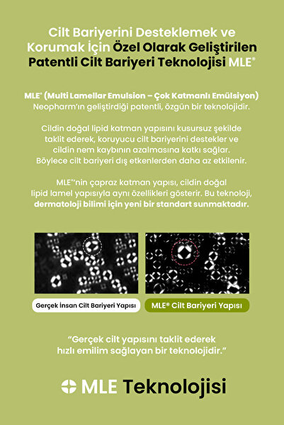zeroid Aşırı Kuru ve Hassas Ciltlere Bariyer Desteği Sunan Yoğun Bakım Kremi Intensive Oint-Cream