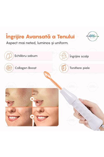 LittleDomi Electroderm, LittleDomi, Tratament cu Frecventa Inalta pentru Acnee, Riduri, Controlul Petelor