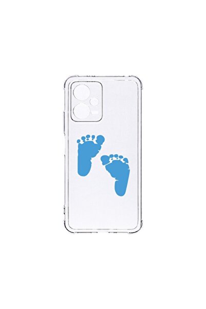 bestcase Husa BestCase¬Æ Anti Shock 1,5MM, Compatibila Cu Xiaomi Redmi Note 1...