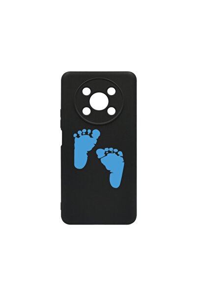 bestcase Husa BestCase¬Æ SLIM SIlicon 0.8MM, Compatibila Cu Honor Magic4 Lite...