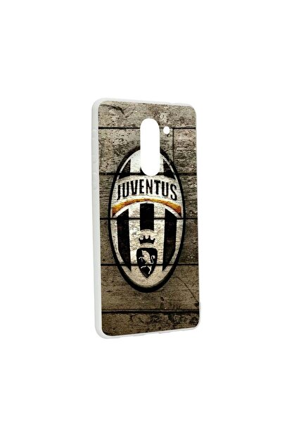 bestcase Husa de protectie Football, Juventus pentru Huawei Mate 9 Lite / Hon...