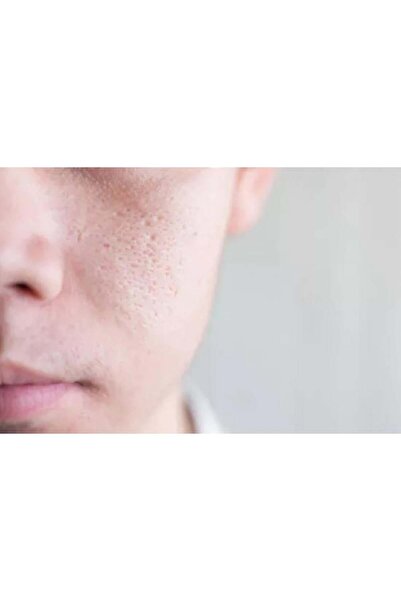 Dermadoctor Dermadcteur Pictcher Perfect Pore Cleanser 30 ml