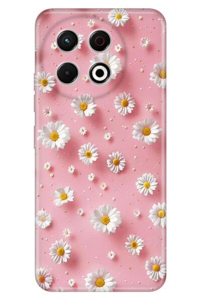 TECNO Spark 30 Pro Kılıf Süslü Duvar Temalı Desenli Darbe Emici Silikon