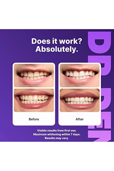 PRO 14 Gentle Purple Daily Teeth Whitening Strips, 7/21 Treatment