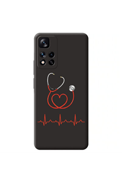 Other Xiaomi Redmi Note 11 Pro 5G Stethoscope Black Colored Silicone TPU Θήκη