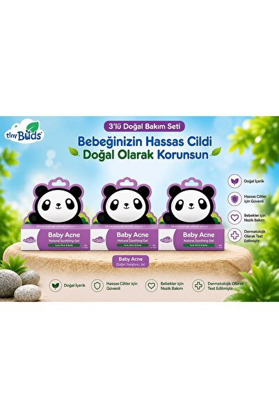 Tıny Buds 3'lü Baby Acne Bebek Aknesi Yatıştırıcı Krem 3X20GR