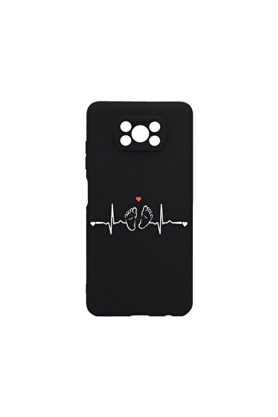 bestcase Λεπτή Θήκη Σιλικόνης 0.8MM, Συμβατή με Xiaomi Poco X3 Pro, My Little...