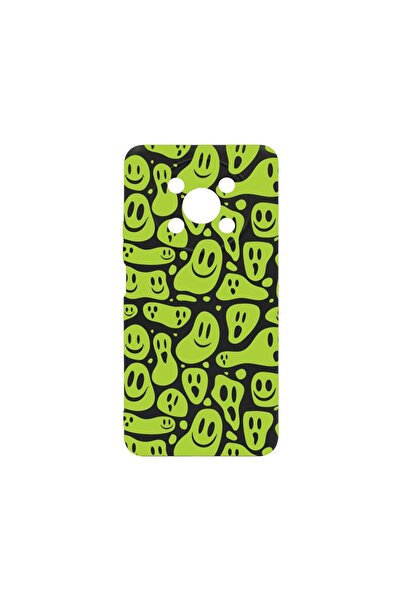 bestcase Λεπτή Θήκη Σιλικόνης 0.8MM, Συμβατή με Honor Magic4 Lite, Πράσινο Αι...