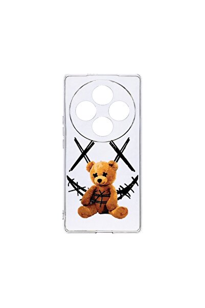 bestcase Θήκη Διαφανής Σιλικόνη 2MM, Συμβατή με OPPO Reno12 FS / Reno12 F, Χα...