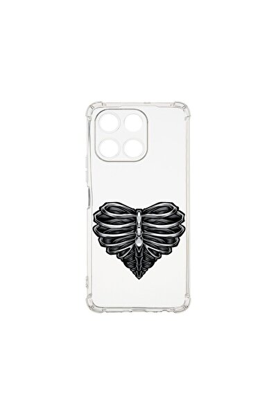 bestcase Husa BestCase¬Æ Anti Shock 1.5MM, Compatibila Cu Honor X6a, Skeleton...