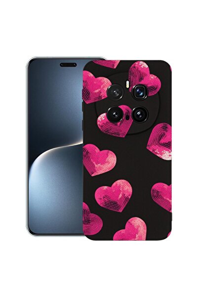 bestcase Θήκη για Honor Magic7 Pro, Προστατευτική λεπτή θήκη σιλικόνης υψηλής...