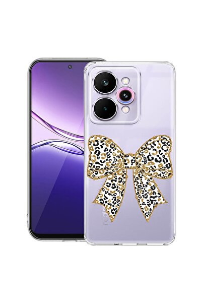 bestcase Διαφανής Λεπτή Θήκη Σιλικόνης Συμβατή με Realme 15 / 15 Pro, Λεοπάρ ...