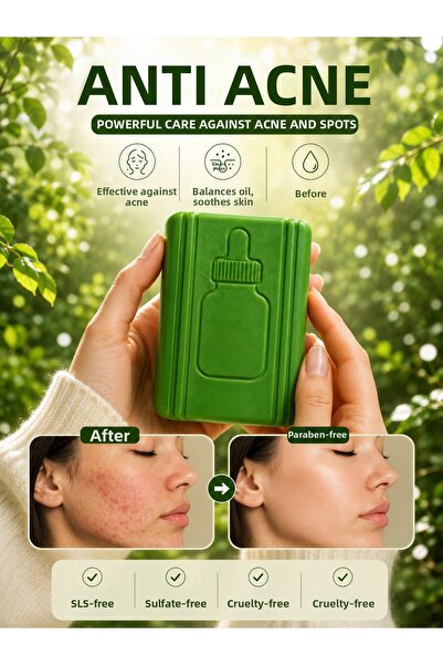 EPİZEN Pore Purifying Soap Cleanses the Skin Without Drying It, Leaving a Sof...