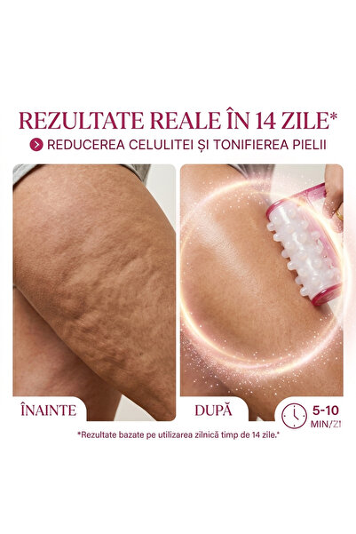 miraza Rola masaj anticelulitic, relaxare musculara, tonifiere, anticelulitic, ergonomic, portabil