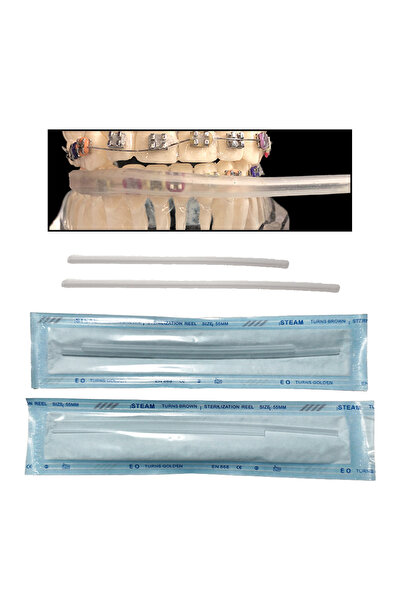 Choice 1 set 1 set of transparent orthodontic cheek tube protective cover, co...