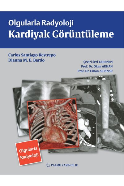 Palme Yayınevi Olgularla Radyoloji Kardiyak Görüntüleme