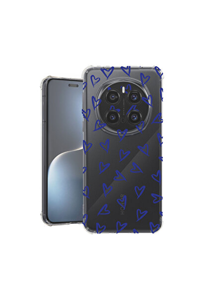 bestcase Αντικραδασμική Θήκη για Honor Magic7 Pro, με Χαριτωμένο Σχέδιο Καρδι...