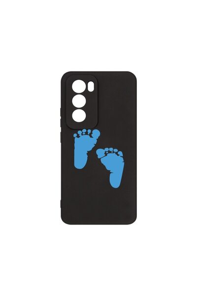 bestcase Θήκη Σιλικόνης Premium, Συμβατή με OPPO Reno12, Σχέδιο Ποδιών Αγοριο...