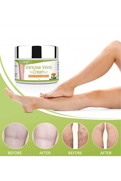 Bezos Varicose Veins Var.is Kremi 100 ML