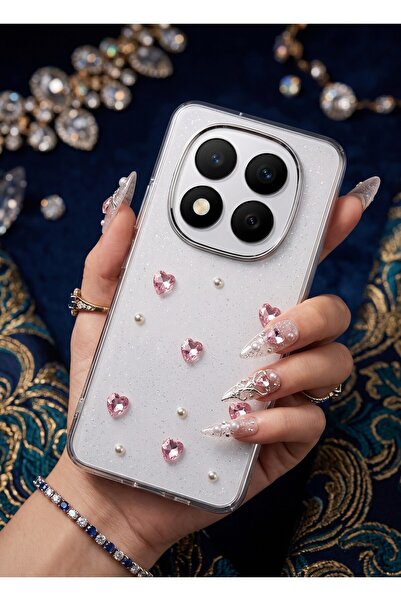 AKSEFİZZ Redmi Note 15 Pro Plus 5G - Poco M8 Pro Kılıf Zarif Mini Figür Desen...