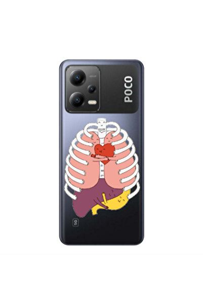 Other Xiaomi Poco X5 Anatomy Transparent Silicone TPU Θήκη