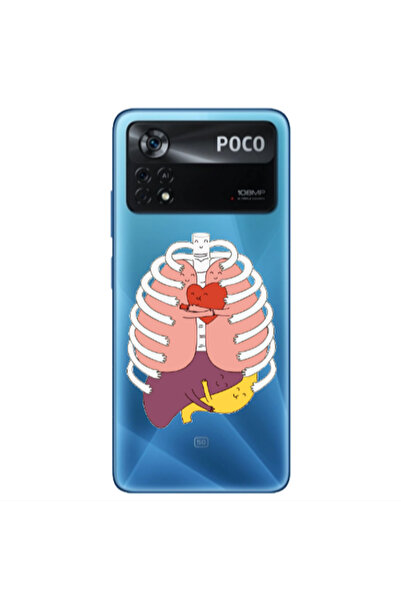 Other Xiaomi Poco X4 Pro Anatomy Transparent Silicone TPU Θήκη