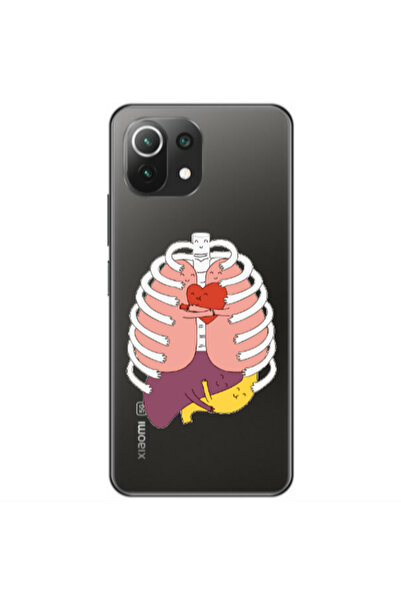 Other Xiaomi Mi 11 Lite Anatomy Transparent Silicone TPU Θήκη
