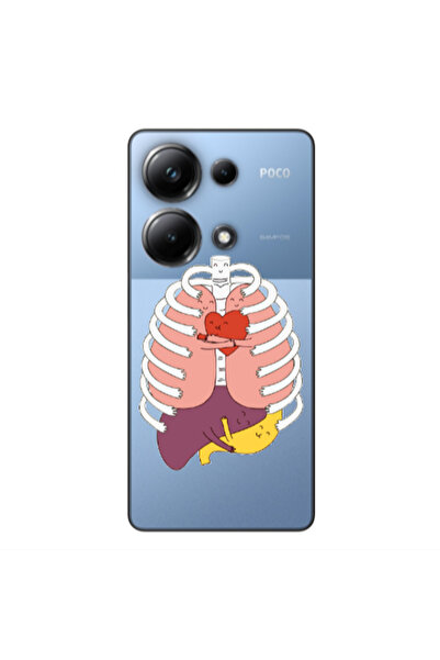 Other Xiaomi Poco M6 Pro 4G Anatomy Transparent Silicone TPU Θήκη