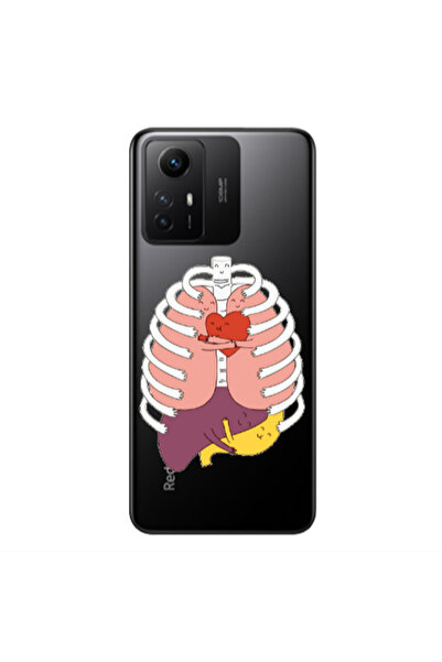 Other Xiaomi Redmi Note 12s Anatomy Transparent Silicone TPU Θήκη