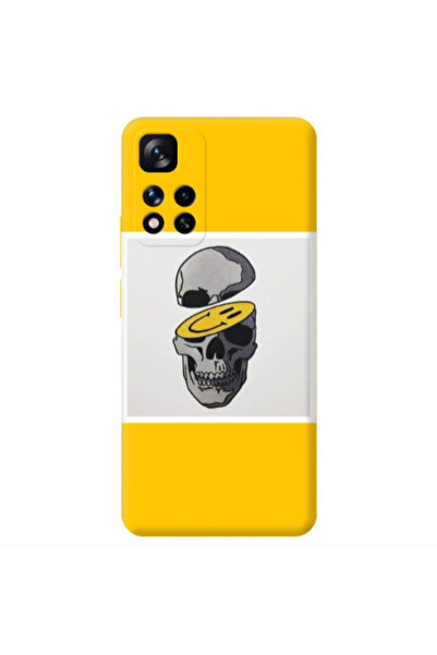 Other Xiaomi Redmi Note 11 Pro 5G Smiley dry head Transparent Silicone TPU Θήκη