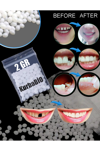 KURBE Pro Thermo Granül 2 Gram Protez Geçici Diş Yapımı, Eksik Diş Giderme, K...