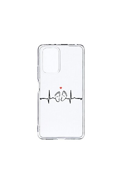 bestcase Прозрачен силиконов калъф 2ММ, съвместим с Xiaomi Redmi Note 10 Pro,...
