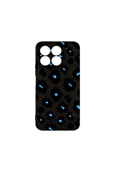 bestcase Θήκη Σιλικόνης Premium, Συμβατή με Honor X8B, Μπλε Σχέδιο Λεοπάρδαλη...