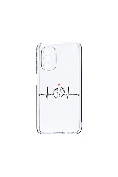 bestcase Husa BestCase¬Æ Clear Silicon 2MM, Compatibila Cu Motorola Moto G51 ...