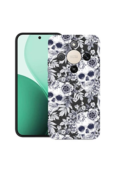 bestcase Ултра тънък TPU калъф, съвместим с Honor Magic8 Lite, Черен и бял че...