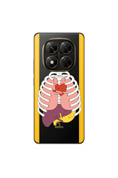 Other Xiaomi Poco X7 Anatomy Transparent Silicone TPU Θήκη