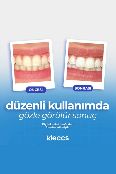 kleccs Teeth Whitening Strips, Professional Whitening, 14 Packs-28 Strips