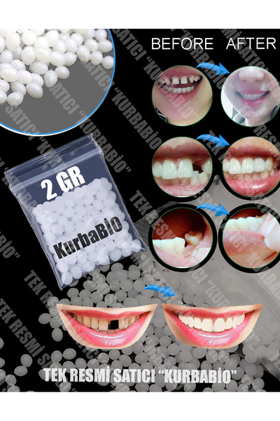 KURBE Pro Thermo Granül 2 Gram Protez Geçici Diş Yapımı, Eksik Diş Giderme, K...
