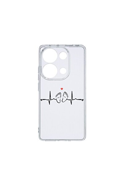bestcase Husa BestCase¬Æ Διαφανής Σιλικόνη 2MM, Συμβατή με Poco M6 Pro 4G, My...