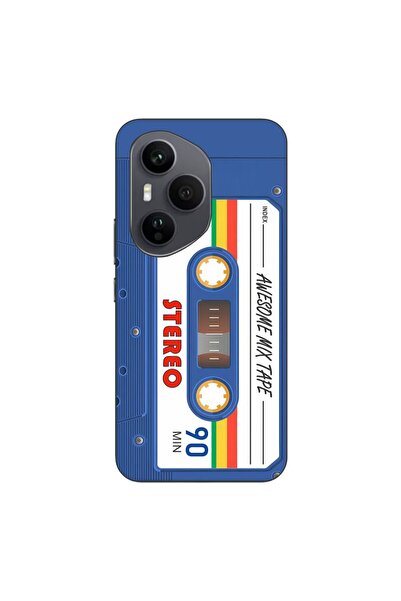 OEM Husa compatibila cu Honor 400 Pro Silicon Gel Tpu Model Caseta Vintage Mi...