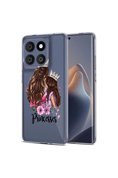 bestcase Husa pentru Motorola Edge 60 Fusion 5G, BestCase¬Æ Clear Silicon 2MM...