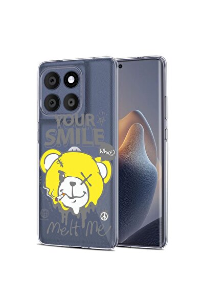 bestcase Калъф за Motorola Edge 60 Fusion 5G, BestCase™ Прозрачен силикон 2ММ...