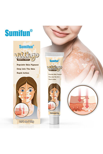 SUMIFUN كريم المتطور للعناية بالبهاق وتوحيد لون البشرة (20 جرام)