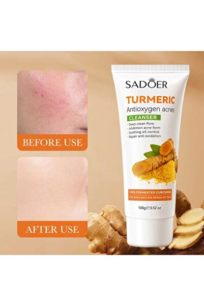 SADOER High Quality Deep Cleansing Moisturizing Anti Oxygen Fades Blemishes A...
